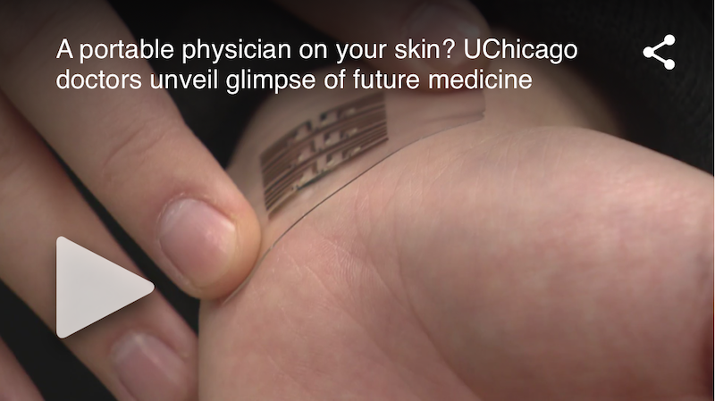 A portable physician on your skin? UChicago doctors unveil glimpse of future medicine – WGN